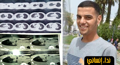 نداء إنساني لمساعدة الطالب يوسف أحطري في تحمل مصاريف علاجه من مرض سرطان المعدة نداء إنساني لمساعدة الطالب يوسف أحطري في تحمل مصاريف علاجه من مرض سرطان المعدة