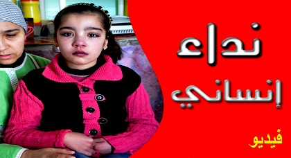 نداء إنساني عاجل لإنقاذ الطفلة "هند" في حاجة إلى عملية جراحية مستعجلة على مستوى القلب