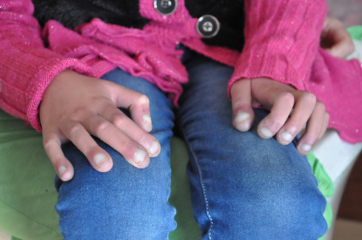 نداء إنساني عاجل لإنقاذ الطفلة "هند" في حاجة إلى عملية جراحية مستعجلة على مستوى القلب نداء إنساني عاجل لإنقاذ الطفلة "هند" في حاجة إلى عملية جراحية مستعجلة على مستوى القلب