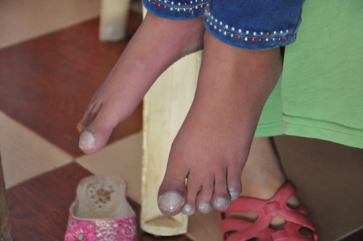 نداء إنساني عاجل لإنقاذ الطفلة "هند" في حاجة إلى عملية جراحية مستعجلة على مستوى القلب نداء إنساني عاجل لإنقاذ الطفلة "هند" في حاجة إلى عملية جراحية مستعجلة على مستوى القلب