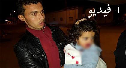 طفلة تنزف دما في حضن والدها والمركز الصحي بالدريوش يرفض نقلها عبر سيارة الاسعاف طفلة تنزف دما في حضن والدها والمركز الصحي بالدريوش يرفض نقلها عبر سيارة الاسعاف