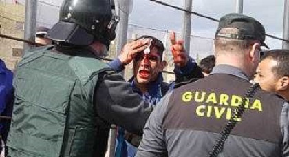 بالفيديو: الحرس المدني بمعبر مليلية يشّق رأس شابّ ناظوري بواسطة زرواطة حديدية