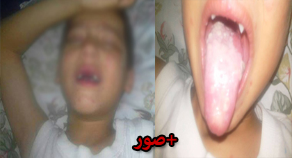 نسيم طفل من تمسمان يناشدكم مساعدته على العلاج من داء نادر ينهش جسده الصغير نسيم طفل من تمسمان يناشدكم مساعدته على العلاج من داء نادر ينهش جسده الصغير