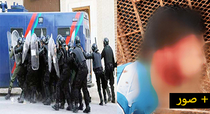 صحف وطنية: الأمن يمر للسرعة القصوى لخنق الحراك ودماء النشطاء تسيل في الشوارع – صور