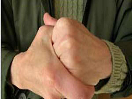 أخطار طرقعة الأصابع أخطار طرقعة الأصابع