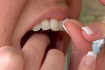 عادات سيئة تدمر أسنانك عادات سيئة تدمر أسنانك