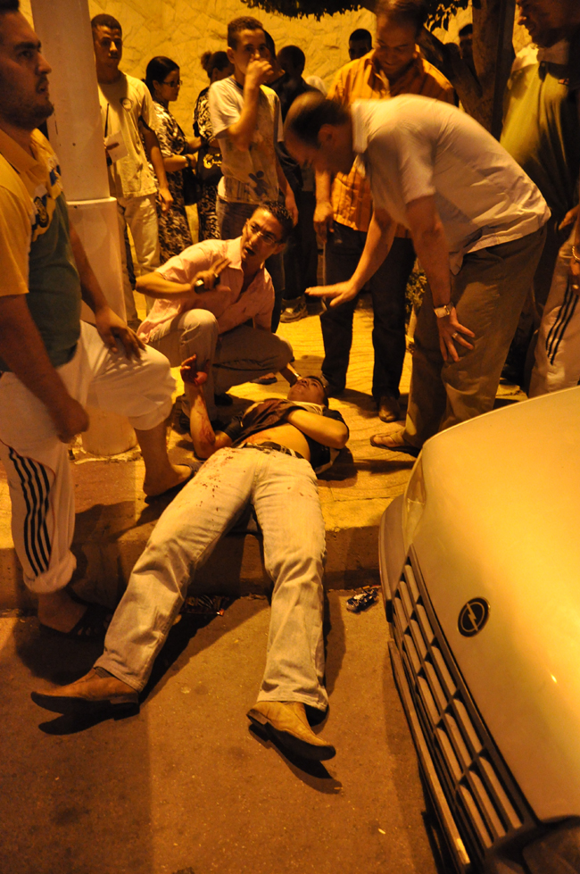 عصابة إجرامية تعتدي على شاب بكورنيش الناظور عصابة إجرامية تعتدي على شاب بكورنيش الناظور