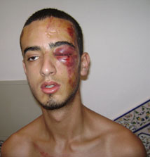 عراك بين شابين يضع جهازي الصحة والقضاء أمام المساءلة في الحسيمة عراك بين شابين يضع جهازي الصحة والقضاء أمام المساءلة في الحسيمة