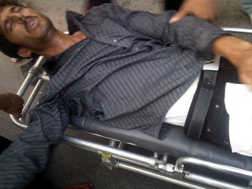 إصابات خطيرة في صفوف معطلي الحسيمة إثر تدخل وحشي لقوى القمع إصابات خطيرة في صفوف معطلي الحسيمة إثر تدخل وحشي لقوى القمع