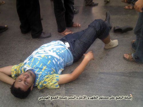 إصابات خطيرة في صفوف معطلي الحسيمة إثر تدخل وحشي لقوى القمع إصابات خطيرة في صفوف معطلي الحسيمة إثر تدخل وحشي لقوى القمع