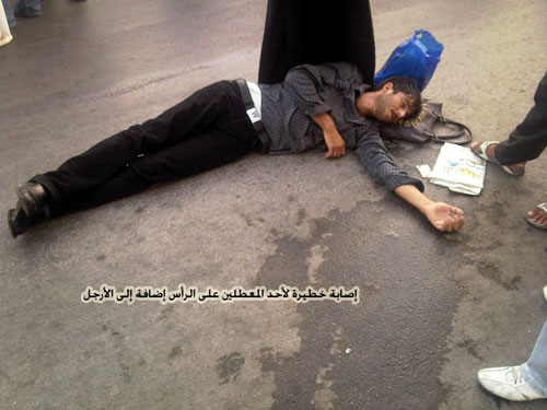 إصابات خطيرة في صفوف معطلي الحسيمة إثر تدخل وحشي لقوى القمع إصابات خطيرة في صفوف معطلي الحسيمة إثر تدخل وحشي لقوى القمع