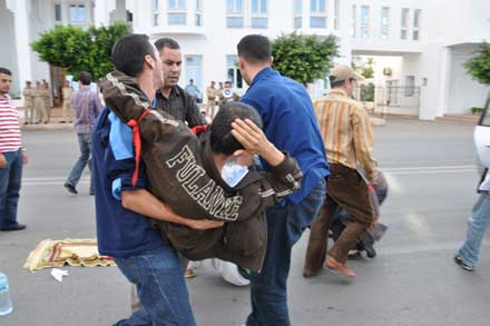 تدخل أمني يسفر عن اصابة عبد العالي البوستاتي خلال الوقفة الاحتجاجية لمعطلي الناظور تدخل أمني يسفر عن اصابة عبد العالي البوستاتي خلال الوقفة الاحتجاجية لمعطلي الناظور