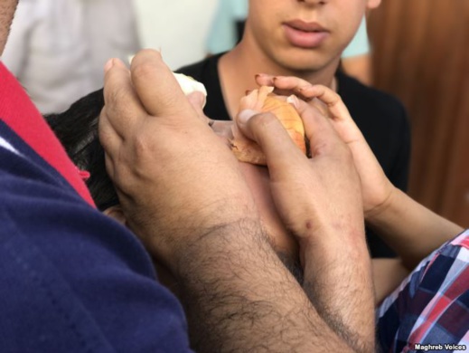 مسيرة 20 يوليوز.. البصل في مواجهة القنابل المسيلة للدموع