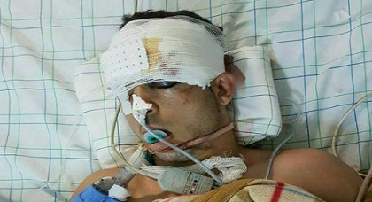 شقيق عماد العتابي: أخي لا يفتح عينيه ولا يحرك أطرافه والطبيب المشرف على حالته يرفض مدي بأي توضيحات شقيق عماد العتابي: أخي لا يفتح عينيه ولا يحرك أطرافه والطبيب المشرف على حالته يرفض مدي بأي توضيحات
