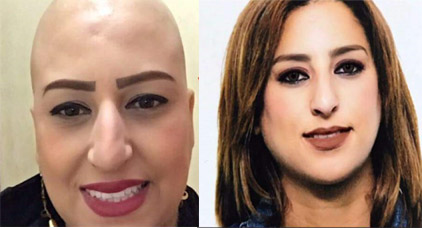 بشرى… مصابة بالسرطان تفارق الحياة بابتسامة أحزنت نشطاء شبكات التواصل بشرى… مصابة بالسرطان تفارق الحياة بابتسامة أحزنت نشطاء شبكات التواصل