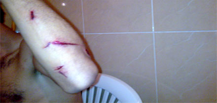 مواجهة دامية داخل كلية الناظور مواجهة دامية داخل كلية الناظور