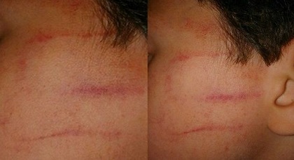 بهذه الطريقة "الخاصة" استقبلت أستاذة تلميذها في أول يوم دراسي واضطرته لرفض العودة للمدرسة بهذه الطريقة "الخاصة" استقبلت أستاذة تلميذها في أول يوم دراسي واضطرته لرفض العودة للمدرسة
