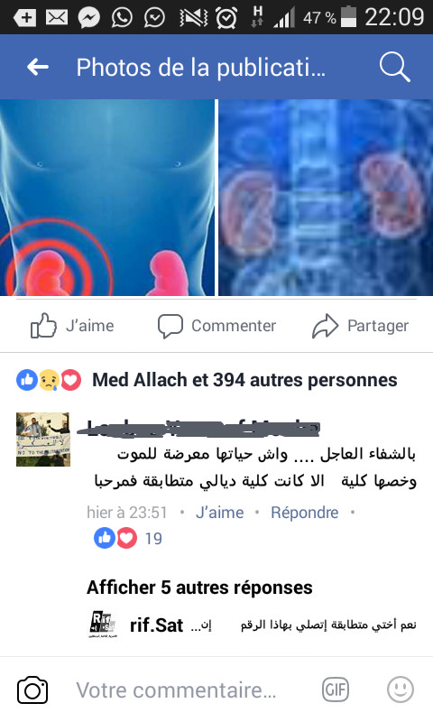 لن تصدق بالصورة: شابة من الحسيمة تتبرع بـ"كليتها" لطفلة بعدما استجابت لنداء هامشي على الفايسبوك لن تصدق بالصورة: شابة من الحسيمة تتبرع بـ"كليتها" لطفلة بعدما استجابت لنداء هامشي على الفايسبوك