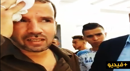 اصابة أستاذ بجرح غائر على مستوى الرأس إثر تعرضه للضرب من طرف تلميذه.. والأمن يدخل على الخط اصابة أستاذ بجرح غائر على مستوى الرأس إثر تعرضه للضرب من طرف تلميذه.. والأمن يدخل على الخط
