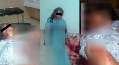حكم قضائي في حق شاب تسبب في 38 غرزة بجسد شابة رفضت الزواج منه يثير صدمة وسط عائلتها حكم قضائي في حق شاب تسبب في 38 غرزة بجسد شابة رفضت الزواج منه يثير صدمة وسط عائلتها