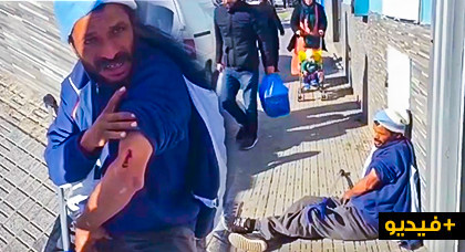 نقل "معاق" مغربي إلى مستشفى مليلية بعد تعرضه للضرب بواسطة هراوة على يد شرطي إسباني نقل "معاق" مغربي إلى مستشفى مليلية بعد تعرضه للضرب بواسطة هراوة على يد شرطي إسباني