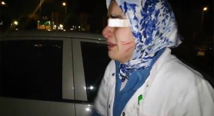 مثير.. خلل في سكانير يدفع مواطنا للاعتداء على موظفة بالمستشفى مثير.. خلل في سكانير يدفع مواطنا للاعتداء على موظفة بالمستشفى