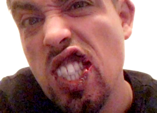 شاهدوا صورة "لارتيست" بعد أن شرمله قطاع طرق قرب منزله بالدار البيضاء شاهدوا صورة "لارتيست" بعد أن شرمله قطاع طرق قرب منزله بالدار البيضاء