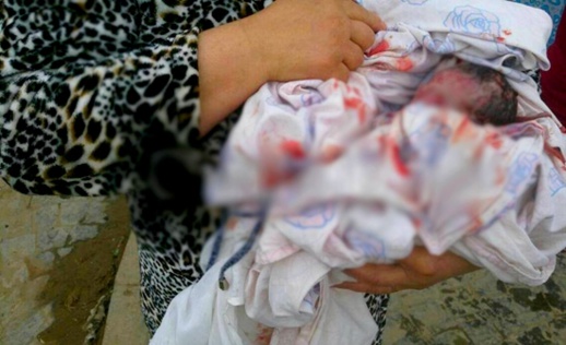 صور صادمة.. سيدة تلد في الشارع العام أمام أنظار المواطنين وتفقد كمية من الدم بعد نزيف حاد صور صادمة.. سيدة تلد في الشارع العام أمام أنظار المواطنين وتفقد كمية من الدم بعد نزيف حاد