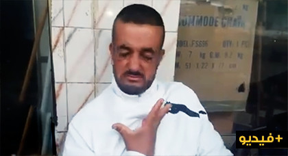 شاب "معاق" يعيش حالة تشرد.. يناشد القلوب الرحيمة مساعدته للعودة إلى أحضان أمه