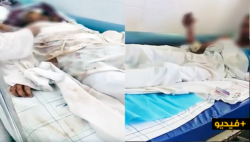 معاناة مرضى "الحروق" داخل أكبر مسشتفيات المغرب.. يطلبون الموت للتخلص من العذاب معاناة مرضى "الحروق" داخل أكبر مسشتفيات المغرب.. يطلبون الموت للتخلص من العذاب