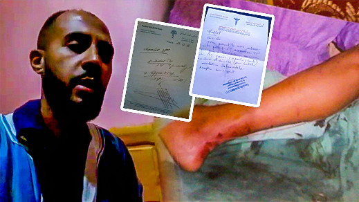 محمد اشملال.. شاب من الحسيمة اعاقه حادث مهني يطالب بمساعدته لانقاذ حياته محمد اشملال.. شاب من الحسيمة اعاقه حادث مهني يطالب بمساعدته لانقاذ حياته