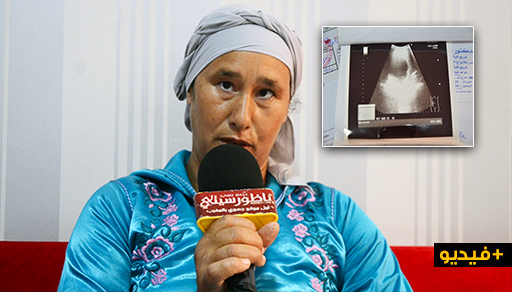 إمرأة من سلوان تعاني من وجود كيسيْن في بطنها وكبدها تناشد مساعدتها على عملية جراحية لاستئصالهما