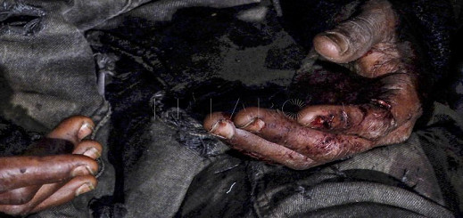 صورة.. الأسلاك الشائكة تمزق أيادي مهاجرين من دول جنوب الصحراء صورة.. الأسلاك الشائكة تمزق أيادي مهاجرين من دول جنوب الصحراء