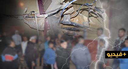 طفل بين الحياة والموت بعد تعرضه لصعقة كهربائية بسبب أسلاك كهربائية عارية بحي براقة طفل بين الحياة والموت بعد تعرضه لصعقة كهربائية بسبب أسلاك كهربائية عارية بحي براقة