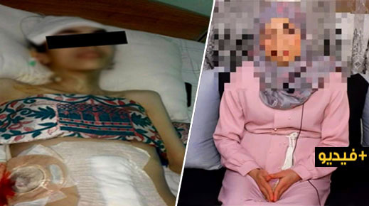 حالة إنسانية مؤلمة.. شابة بالناظور تعاني في صمت بسبب مرض خطير وتخلي الزوج عن إعالتها حالة إنسانية مؤلمة.. شابة بالناظور تعاني في صمت بسبب مرض خطير وتخلي الزوج عن إعالتها