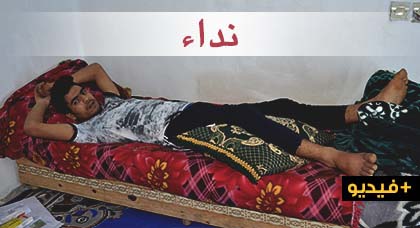 الناظور.. شاب طريح الفراش يوجه نداء مؤثرا للمحسنين من أجل مساعدته على العلاج الناظور.. شاب طريح الفراش يوجه نداء مؤثرا للمحسنين من أجل مساعدته على العلاج