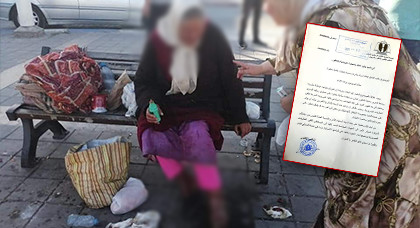 جمعية حقوقية تراسل وكيل الملك وباشا الناظور لإنقاذ حياة متشردة تعفن جلدها جمعية حقوقية تراسل وكيل الملك وباشا الناظور لإنقاذ حياة متشردة تعفن جلدها