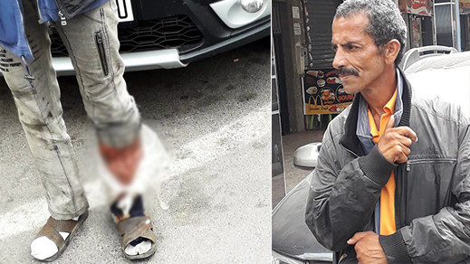 مواطنون يطالبون بانقاذ متشرد بالناظور يعاني تعفنات خطيرة في قدمه مواطنون يطالبون بانقاذ متشرد بالناظور يعاني تعفنات خطيرة في قدمه