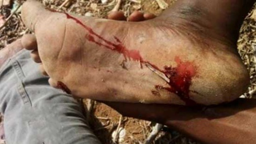 هيئة حقوقية: سلطات أمن الناظور تترصد توجه المهاجرين الأفارقة "المسلمين" إلى المساجد لشن هجماتها هيئة حقوقية: سلطات أمن الناظور تترصد توجه المهاجرين الأفارقة "المسلمين" إلى المساجد لشن هجماتها