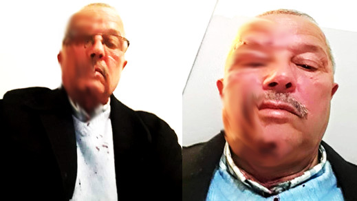 والد تلميذ يتسبب في جرح غائر لمدير مدرسة ابتدائية ببني انصار  والد تلميذ يتسبب في جرح غائر لمدير مدرسة ابتدائية ببني انصار