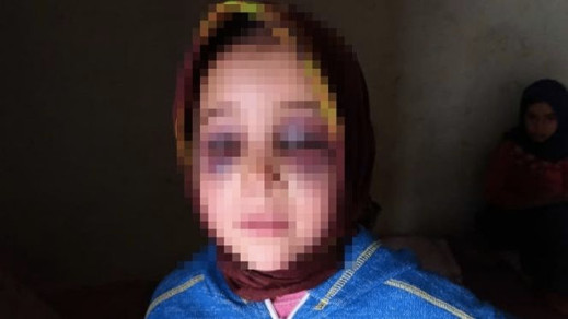 الدرك يحقق في ملابسات تعنيف أستاذ لتلميذة الدرك يحقق في ملابسات تعنيف أستاذ لتلميذة