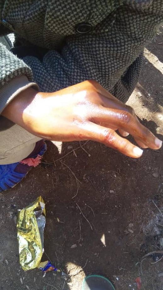 مهاجرون أفارقة يهجمون على معبر فرخانة لاقتحام مليلية وهيئة حقوقية تصف تدخل الأمن بالعنيف + صور مهاجرون أفارقة يهجمون على معبر فرخانة لاقتحام مليلية وهيئة حقوقية تصف تدخل الأمن بالعنيف + صور