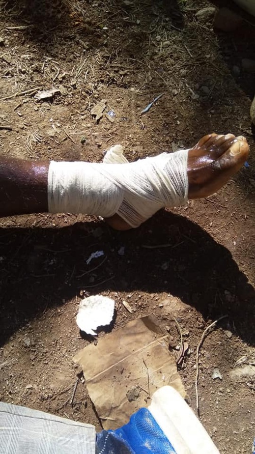 مهاجرون أفارقة يهجمون على معبر فرخانة لاقتحام مليلية وهيئة حقوقية تصف تدخل الأمن بالعنيف + صور مهاجرون أفارقة يهجمون على معبر فرخانة لاقتحام مليلية وهيئة حقوقية تصف تدخل الأمن بالعنيف + صور