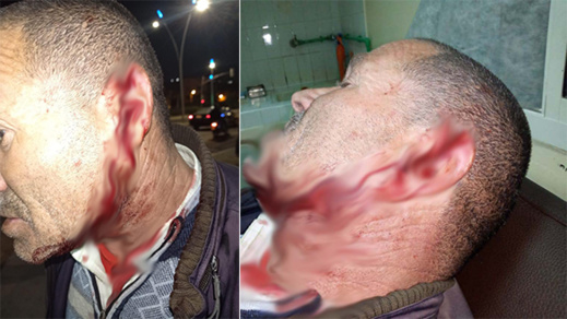 خطير بالناظور: منحرف في حالة سكر طافح يرسل خمسينيا إلى المستعجلات بعد "شرملة" وجهه بسكين خطير بالناظور: منحرف في حالة سكر طافح يرسل خمسينيا إلى المستعجلات بعد "شرملة" وجهه بسكين