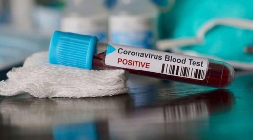 إرتفاع عدد المصابين بفيروس كورونا إلى 77 حالة