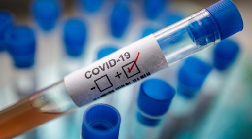 التحاليل المخبرية الخاصة بالكشف عن فيروس كورونا أصبحت تنجز بوجدة التحاليل المخبرية الخاصة بالكشف عن فيروس كورونا أصبحت تنجز بوجدة