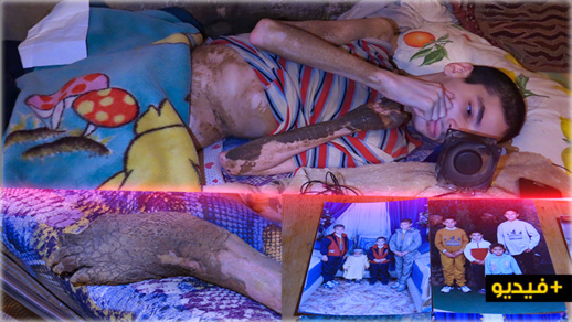 مؤثر.. مصابٌ بمرض غريب استعصى على الأطباء: مررتُ وسط مقبرة بالناظور فشُلّ جسدي وأناشدكم المساعدة مؤثر.. مصابٌ بمرض غريب استعصى على الأطباء: مررتُ وسط مقبرة بالناظور فشُلّ جسدي وأناشدكم المساعدة