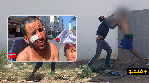 شاهدوا.. حارس السيارات ضحية الاعتداء من طرف "حراكة" بالناظور يروي تفاصيل الواقعة شاهدوا.. حارس السيارات ضحية الاعتداء من طرف "حراكة" بالناظور يروي تفاصيل الواقعة