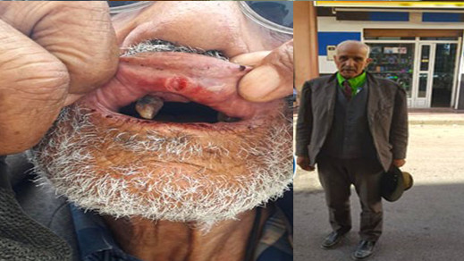 مختلّ عقليا يعتدي على سبعيني في الدريوش ويرسله إلى المستعجلات مختلّ عقليا يعتدي على سبعيني في الدريوش ويرسله إلى المستعجلات