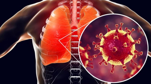 خبراء: الحمل الفيروسي للمصابين بكورونا مرتفع حتى بين من لا تظهر عليهم الأعراض خبراء: الحمل الفيروسي للمصابين بكورونا مرتفع حتى بين من لا تظهر عليهم الأعراض